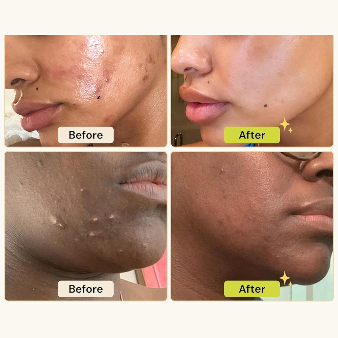 The Pink Foundry Pore Refining & Soothing Clay Mask