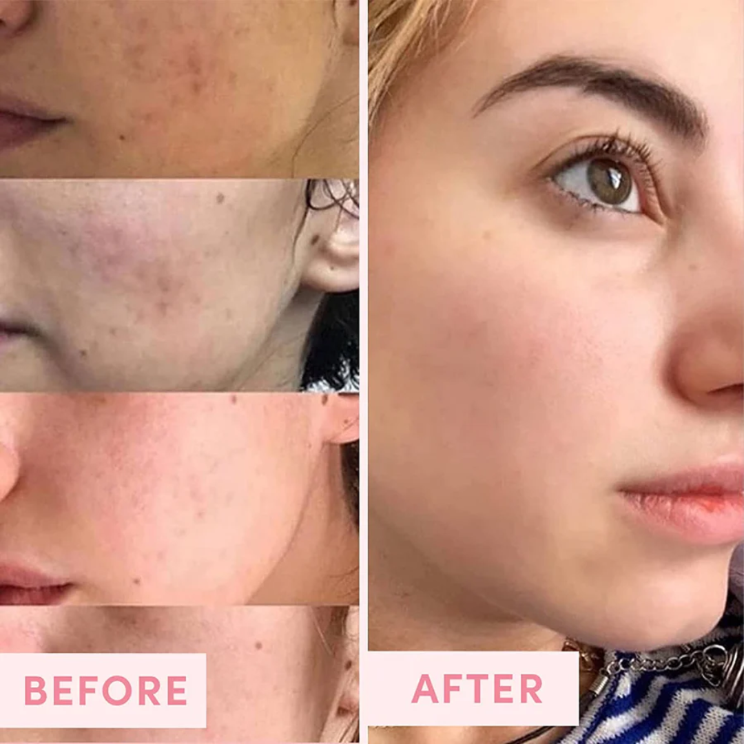 The Pink Foundry Pore Refining & Soothing Clay Mask
