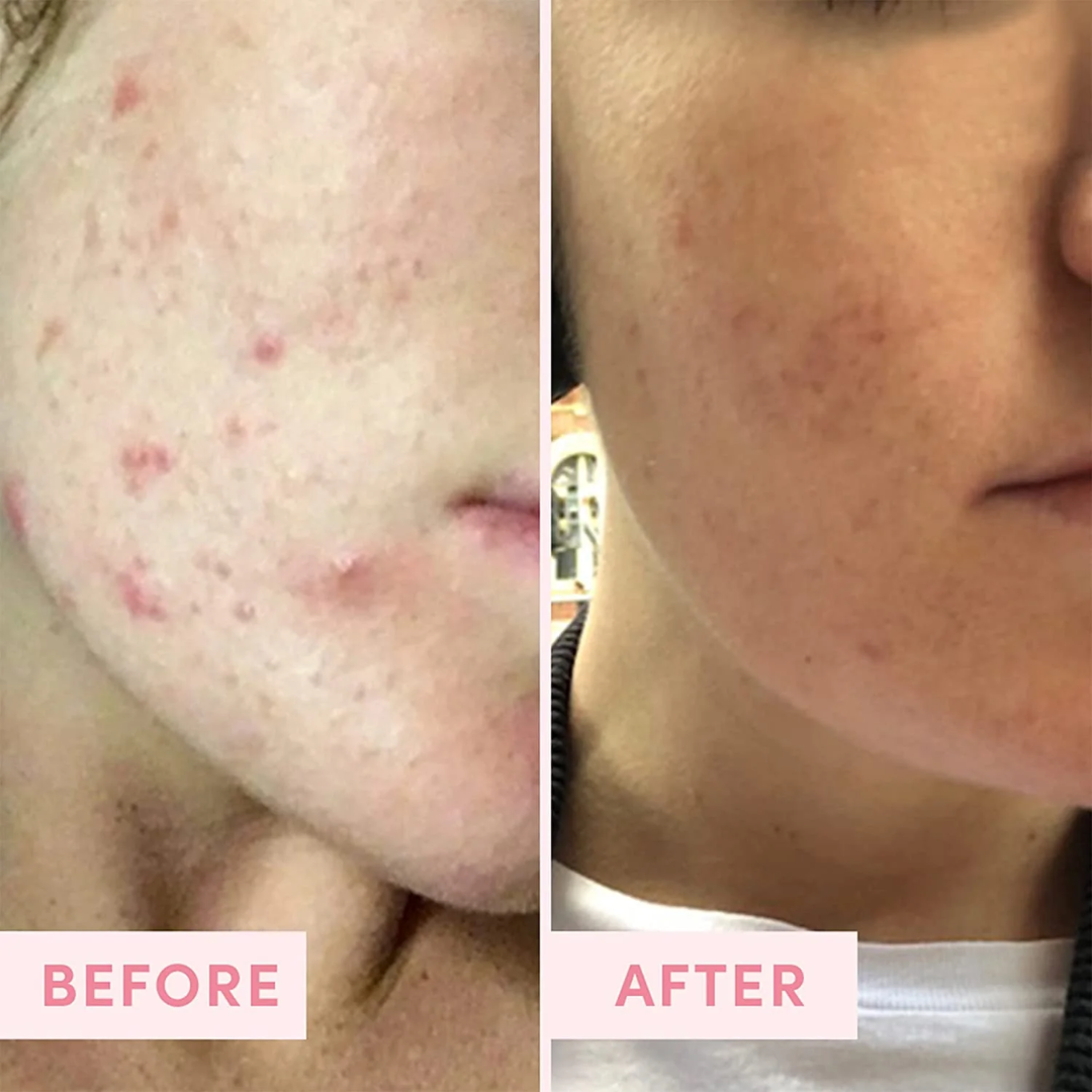 The Pink Foundry Pore Refining & Soothing Clay Mask