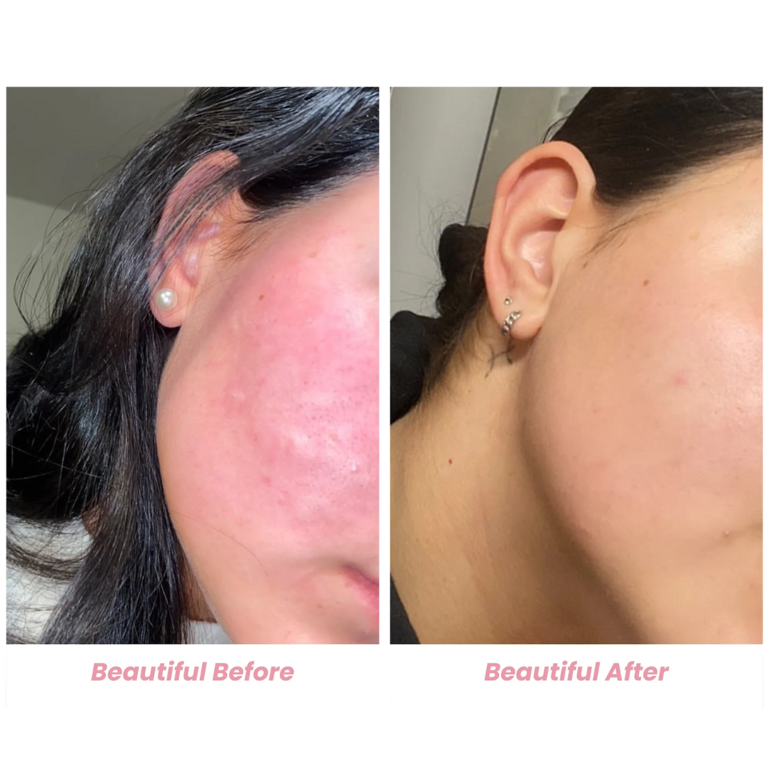 The Pink Foundry Pore Refining & Soothing Clay Mask
