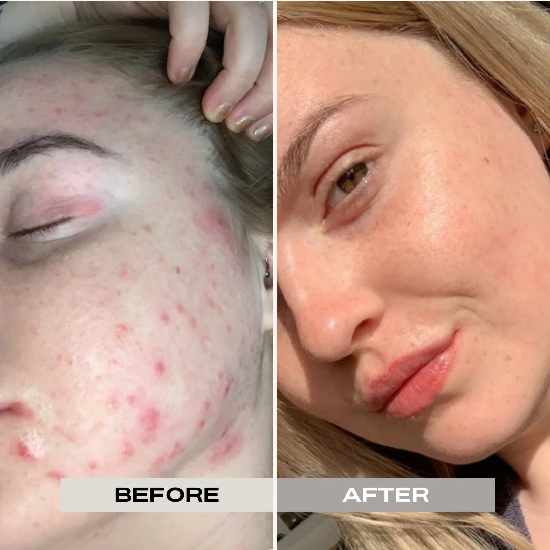 The Pink Foundry Pore Refining & Soothing Clay Mask