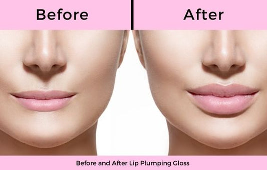 VT Reedle Lip Plumper