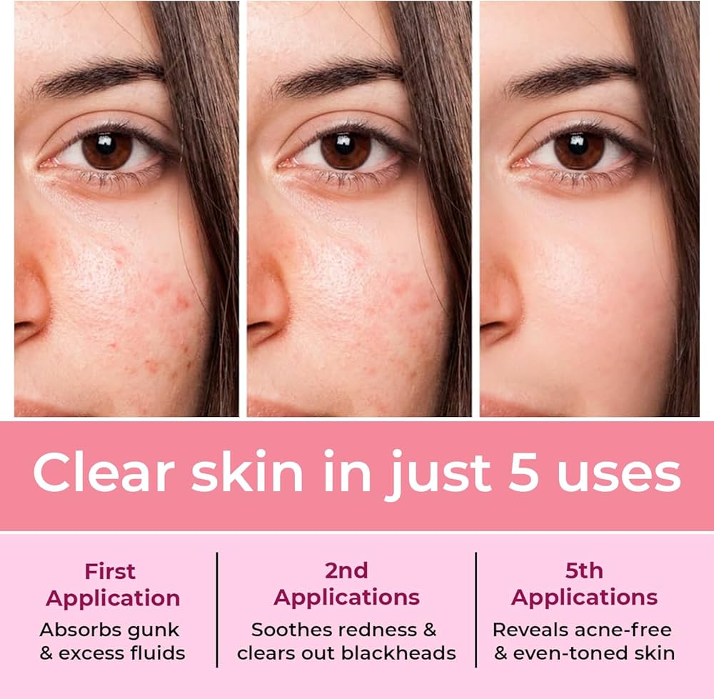 Pimple Patch