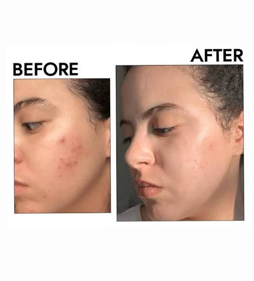 Dr.Althea 345 Soothing Relief Cream - For Sensitive & Acne prone Skin