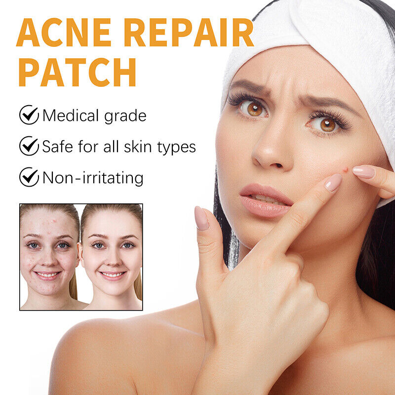 Pimple Patch
